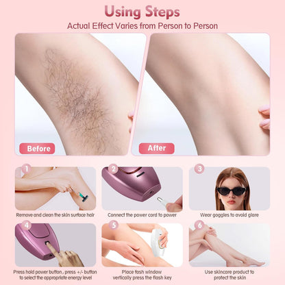 IPL Laser Hair Remover Device V1